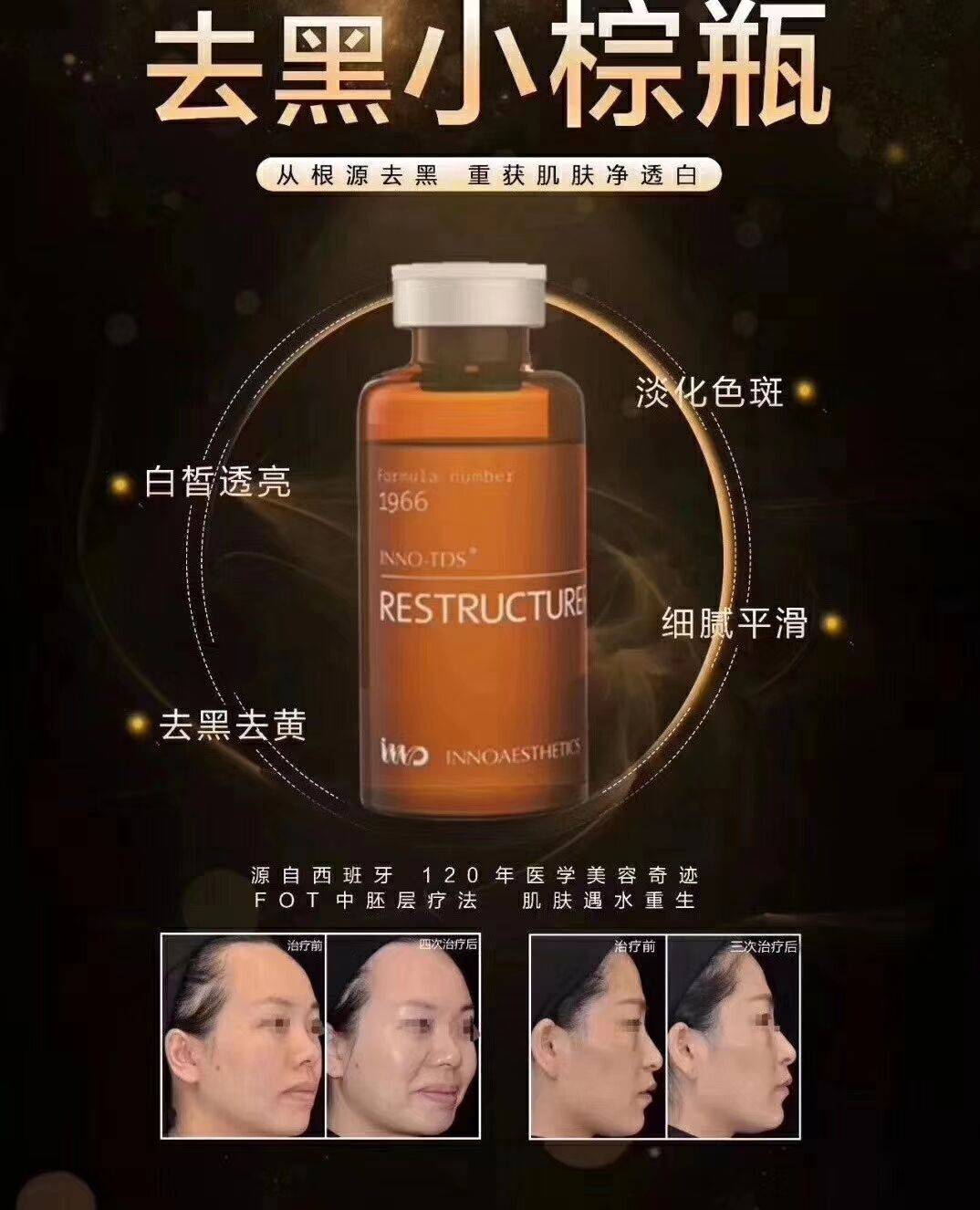 英诺小棕瓶现货